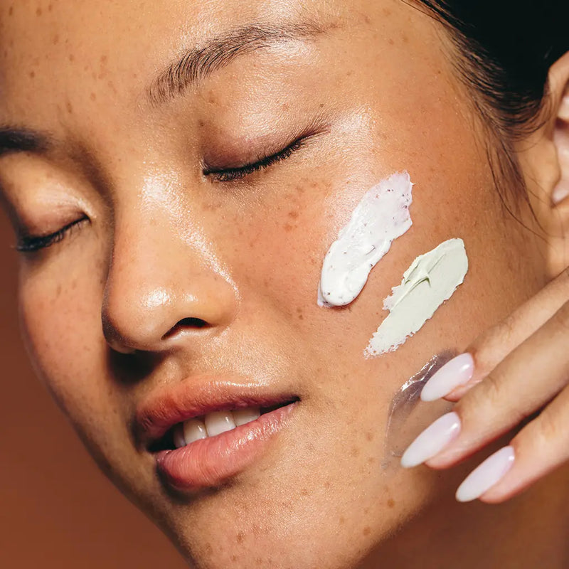 Acne Prone