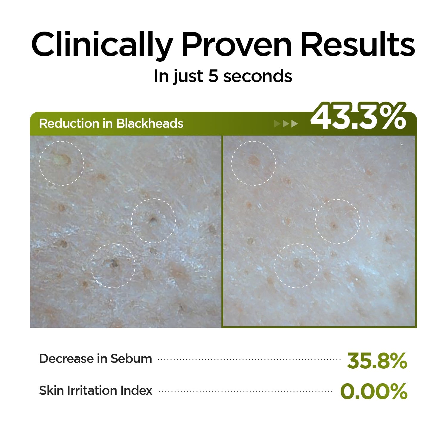 P.CALM - UnderPore Holy Basil Cleansing Oil 190ml
