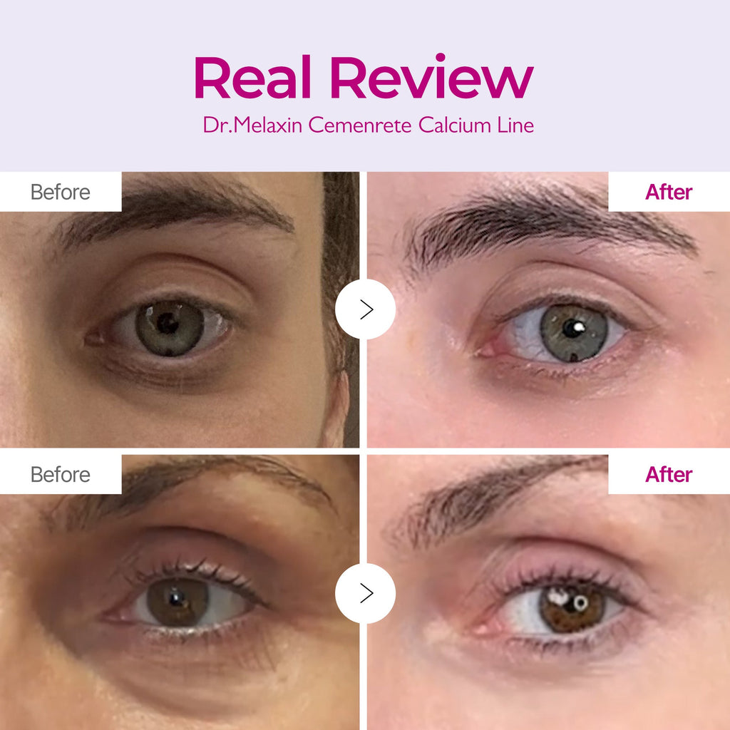 DR MELAXIN - Cemenrete Calcium Intense Ampoule Plus 30ml