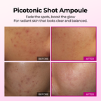 DR MELAXIN - Cemenrete Picotonic Shot Serum 30ml