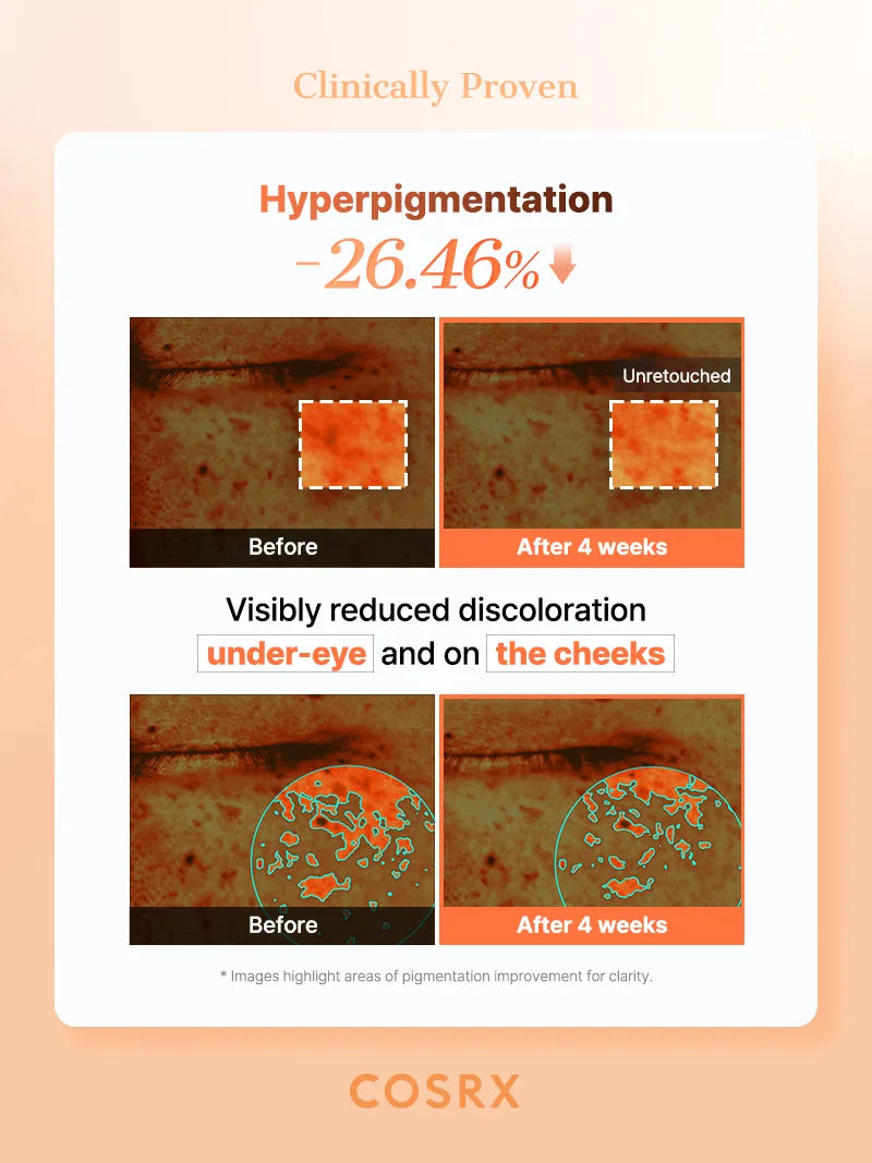 COSRX - 5PDRN Collagen Vitalizing Eye Patch