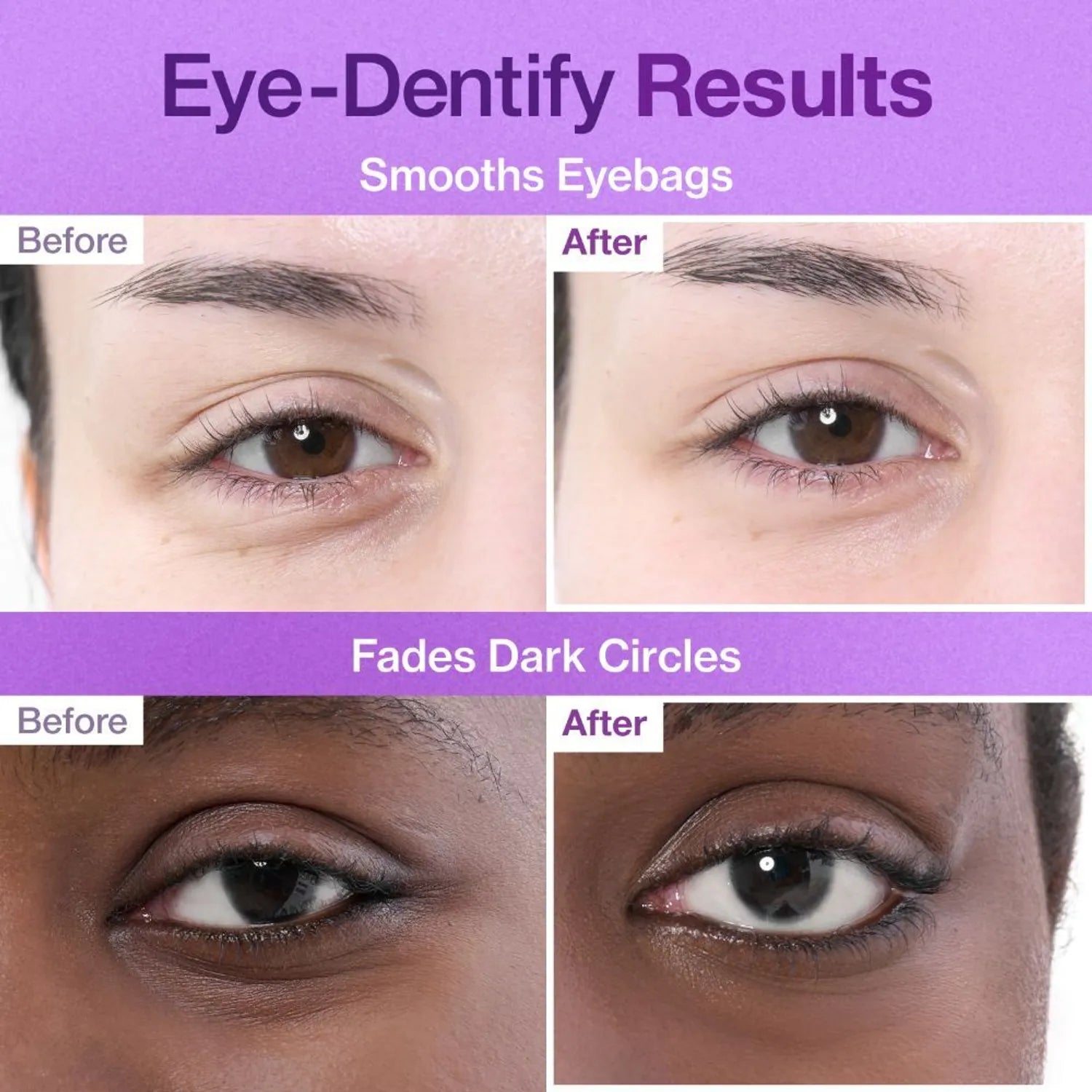 NUMBUZIN No.9 NAD Under Eye Patches – 5 Pairs