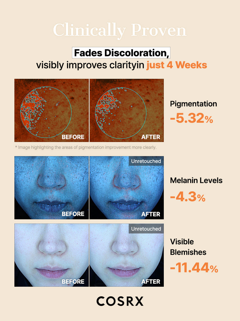 COSRX - The Alpha-Arbutin Discoloration Care Hydrogel Mask 34g x 3