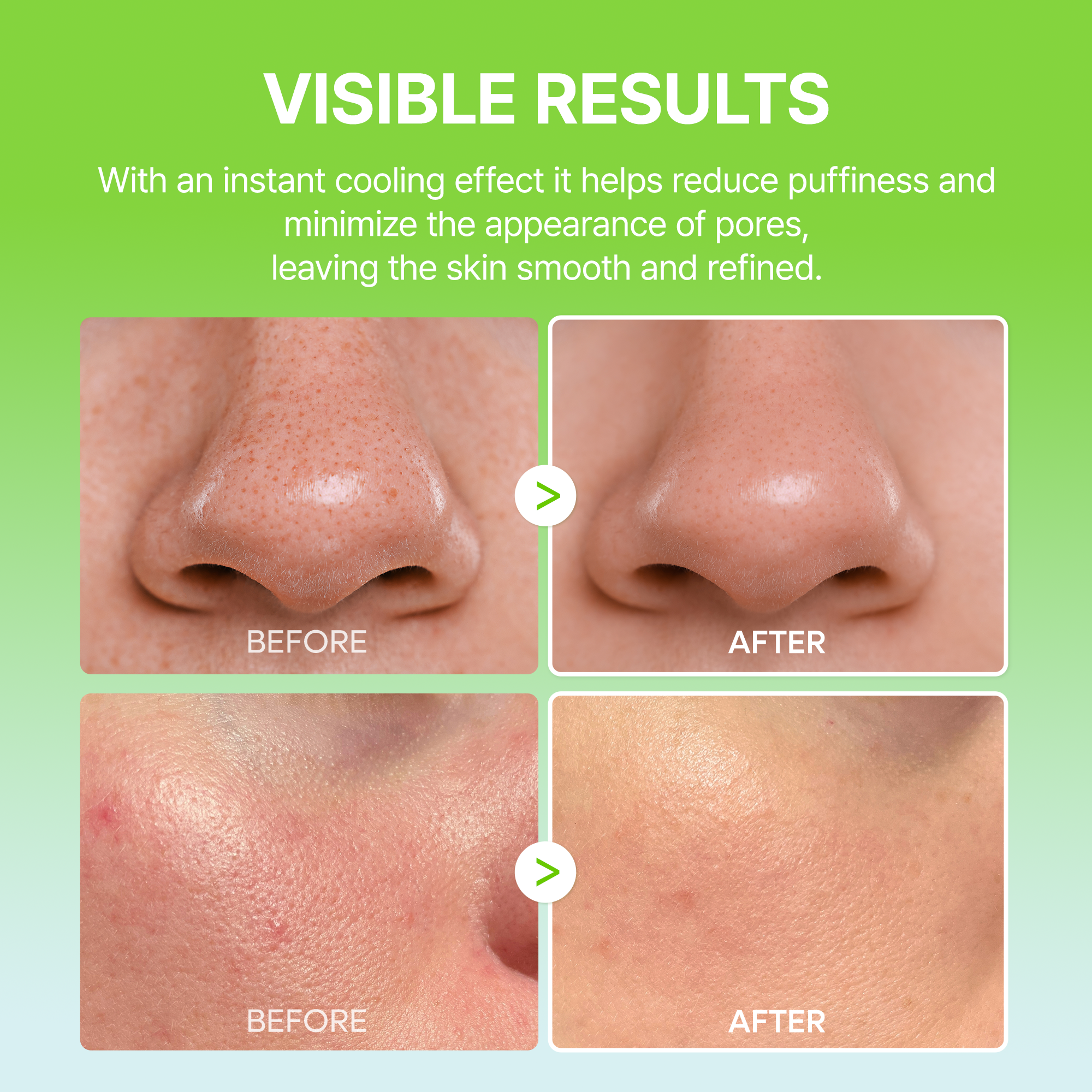 DR MELAXIN - Cactox Pore Relief Multi Balm 25g