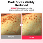 DR MELAXIN - TX-Astaxanthin Dark Spot Care Cream Hydrogel Mask – image 3