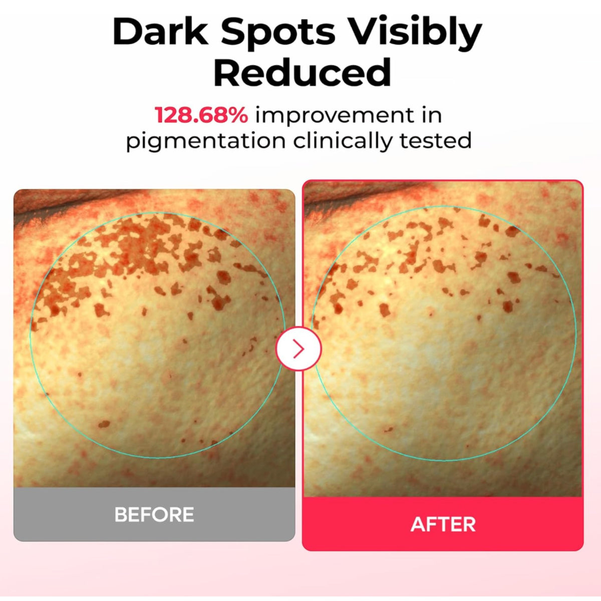 DR MELAXIN - TX-Astaxanthin Dark Spot Care Cream Hydrogel Mask – image 3