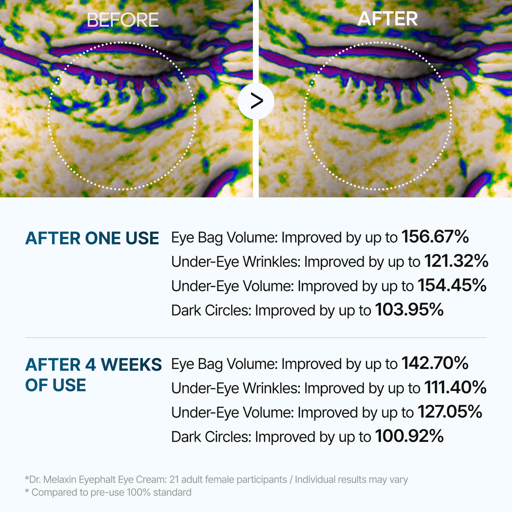 DR MELAXIN - Eyephalt Eyebag Cream 10ml