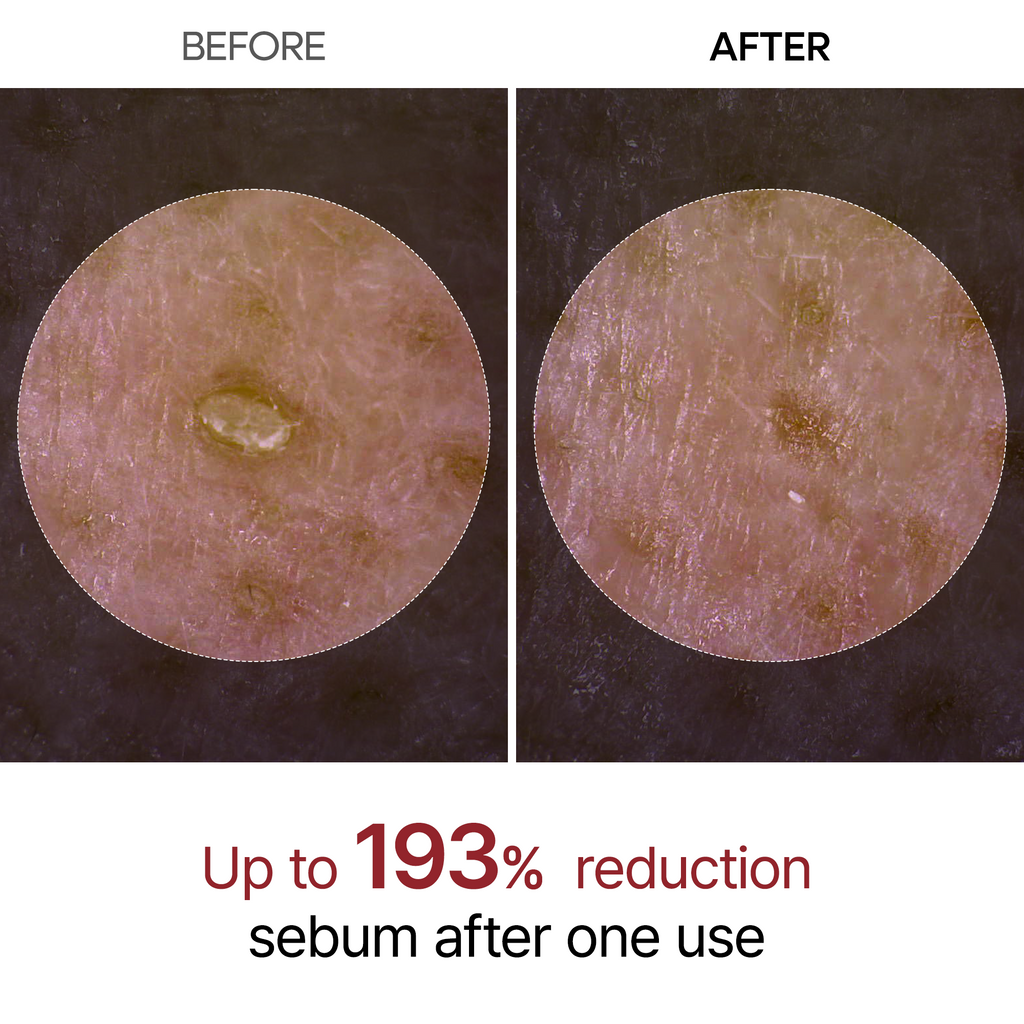 DR MELAXIN - Peel Shot Exfoliating Black Rice Ampoule 80ml