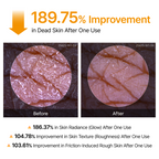 DR MELAXIN - Peel Shot Exfoliating Kojic Acid Turmeric Spray 200ml