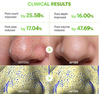 DR MELAXIN - CACTOX 3-STEP NOSE PORE PACK 3GX3EA
