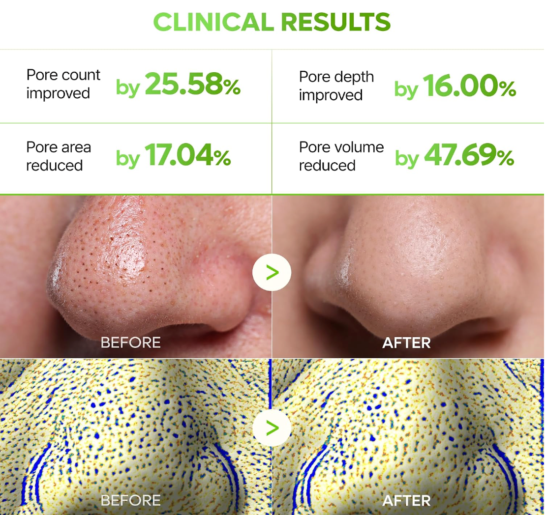DR MELAXIN - CACTOX 3-STEP NOSE PORE PACK 3GX3EA