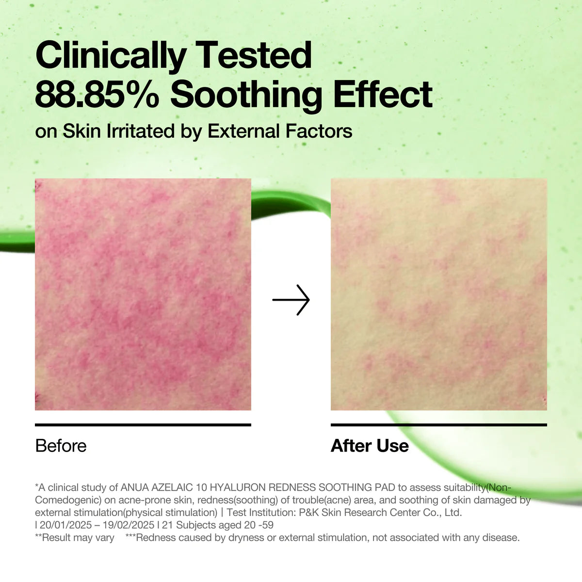 ANUA - Azelaic Acid 10 Hyaluron Redness Soothing Pad 230ml / 90 Pad