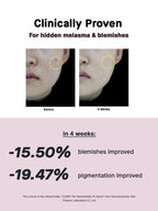 COSRX - The Niacinamide 15 Serum 20ml